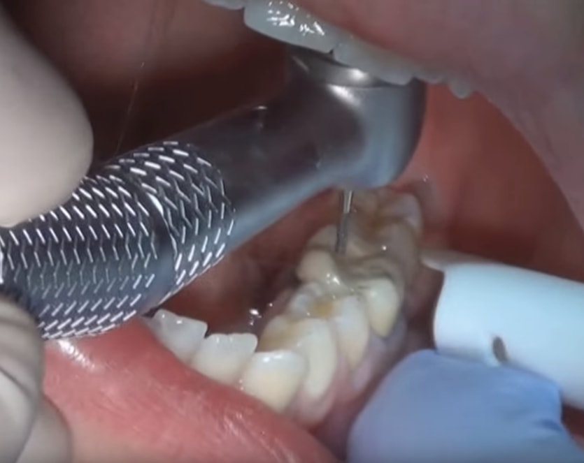 Maple Ridge Dentist - Cedar Ridge Dental | 22195 Dewdney Trunk Rd, Maple Ridge, BC V2X 3H7, Canada | Phone: (604) 463-3931