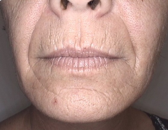 Unique Skin Care | 47 OShaughnessy Crescent, Barrie, ON L4N 7L8, Canada | Phone: (647) 978-1194