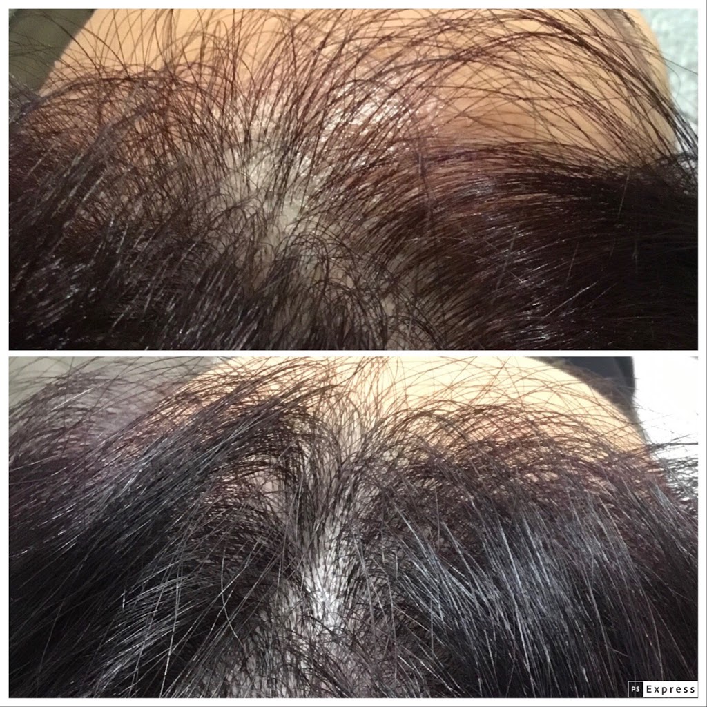 Glow Med Clinic | 11005 Yonge St Unit D2, Richmond Hill, ON L4C 0K7, Canada | Phone: (905) 770-1219