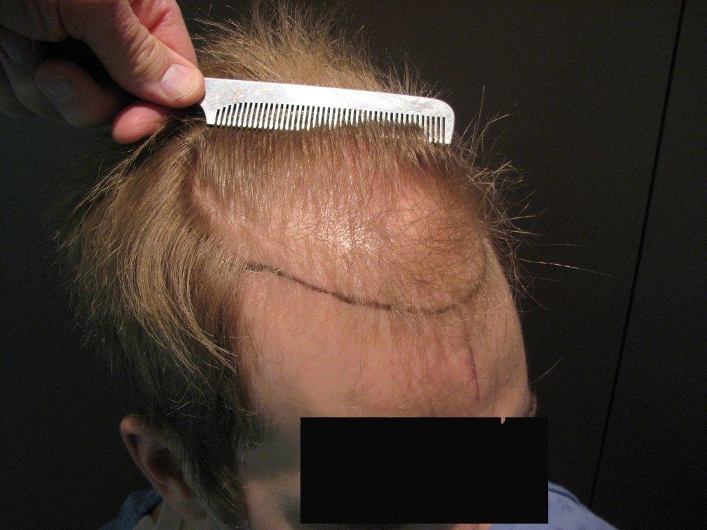 Dr Paul C Cotterill | 21 Bedford Rd, Toronto, ON M5R 2J9, Canada | Phone: (416) 322-0390