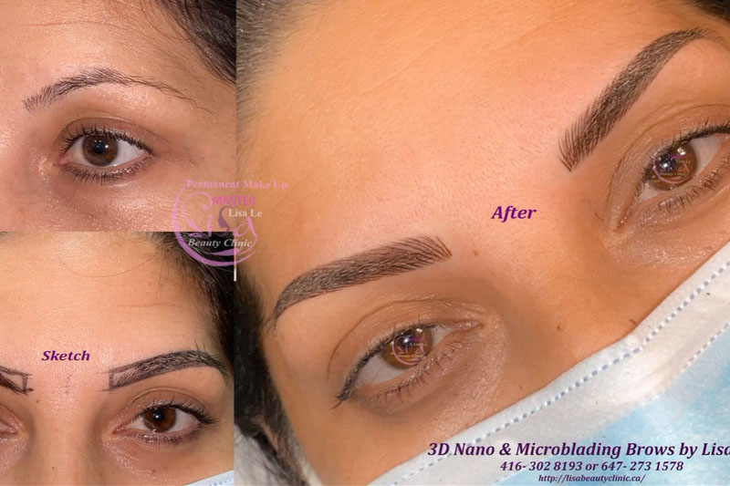 Lisa Beauty Clinic | 3220 Weston Rd, North York, ON M9M 2T7, Canada | Phone: (647) 273-1578