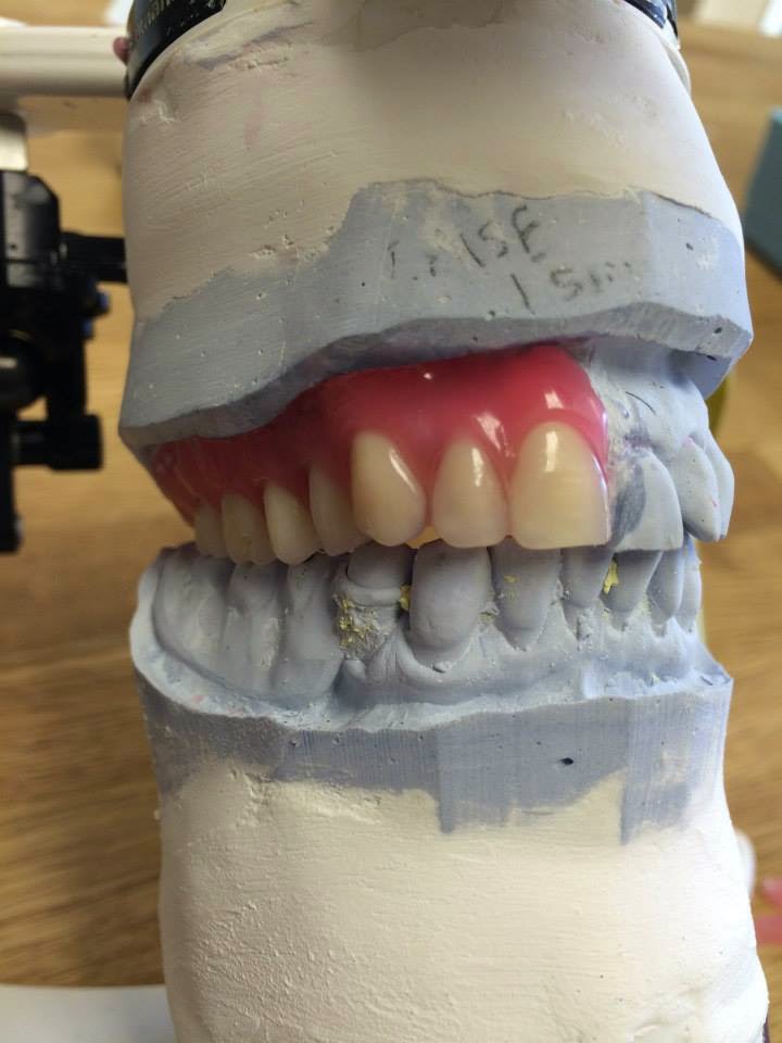 Rizzoli Denture & Implant Clinic | 4504 50 St #6, Stony Plain, AB T7Z 1L5, Canada | Phone: (780) 591-1800