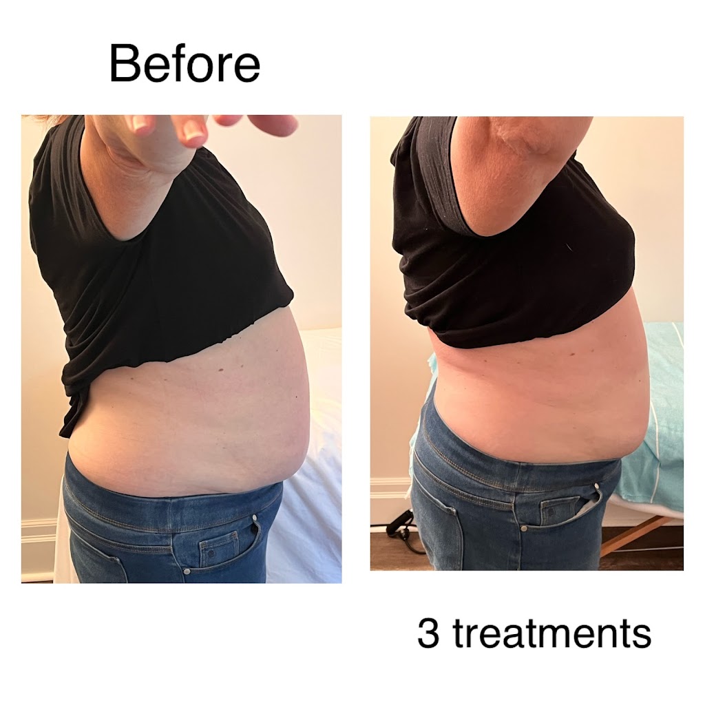 Flawlessly Sculpted Bodies by Patti | 132 St George St, St Thomas, ON N5P 2M1, Canada | Phone: (519) 719-6161