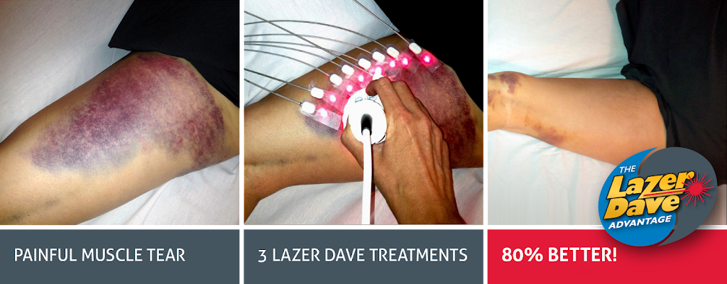 Ottawa Laser Solutions - WESTBORO | 1399 Wellington St. W, Ottawa, ON K1Y 2X1, Canada | Phone: (613) 722-3769