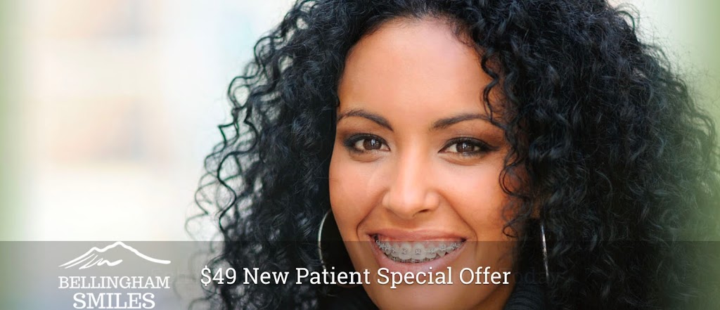 Bellingham Smiles - Family & Cosmetic Dentistry-David A Kavanagh | 1420 King St, Bellingham, WA 98229, USA | Phone: (360) 671-4552
