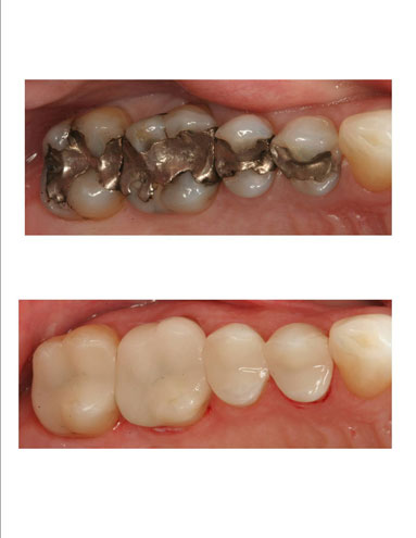 Clinique Dentaire Dac - Dentiste Westmount | 4141 Rue Sherbrooke Ouest #350, Westmount, QC H3Z 1B7, Canada | Phone: (514) 934-0748