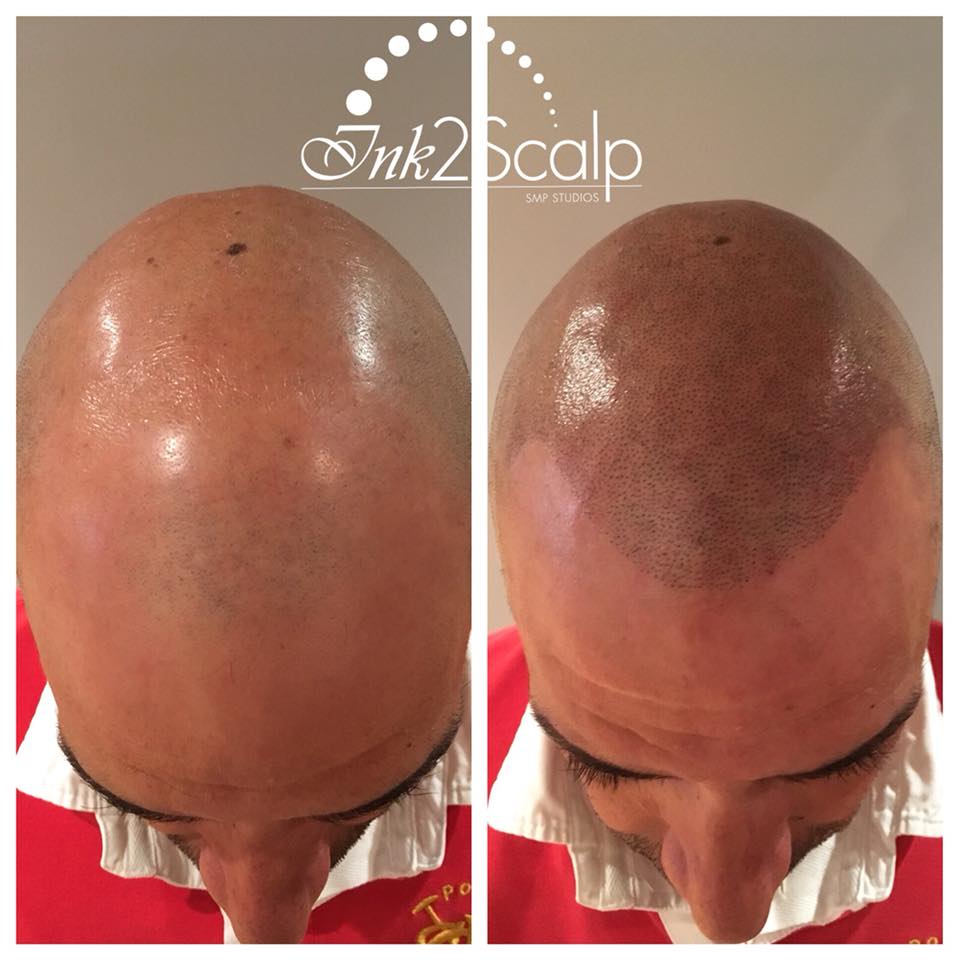Ink2scalp | 6 Teardrop Crescent, Whitby, ON L1M 2N9, Canada | Phone: (905) 259-1251