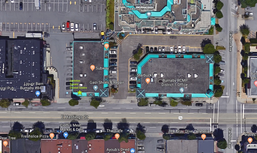 Carleton Square Dental Centre | 4161 Hastings St #101, Burnaby, BC V5C 2J3, Canada | Phone: (604) 294-0294