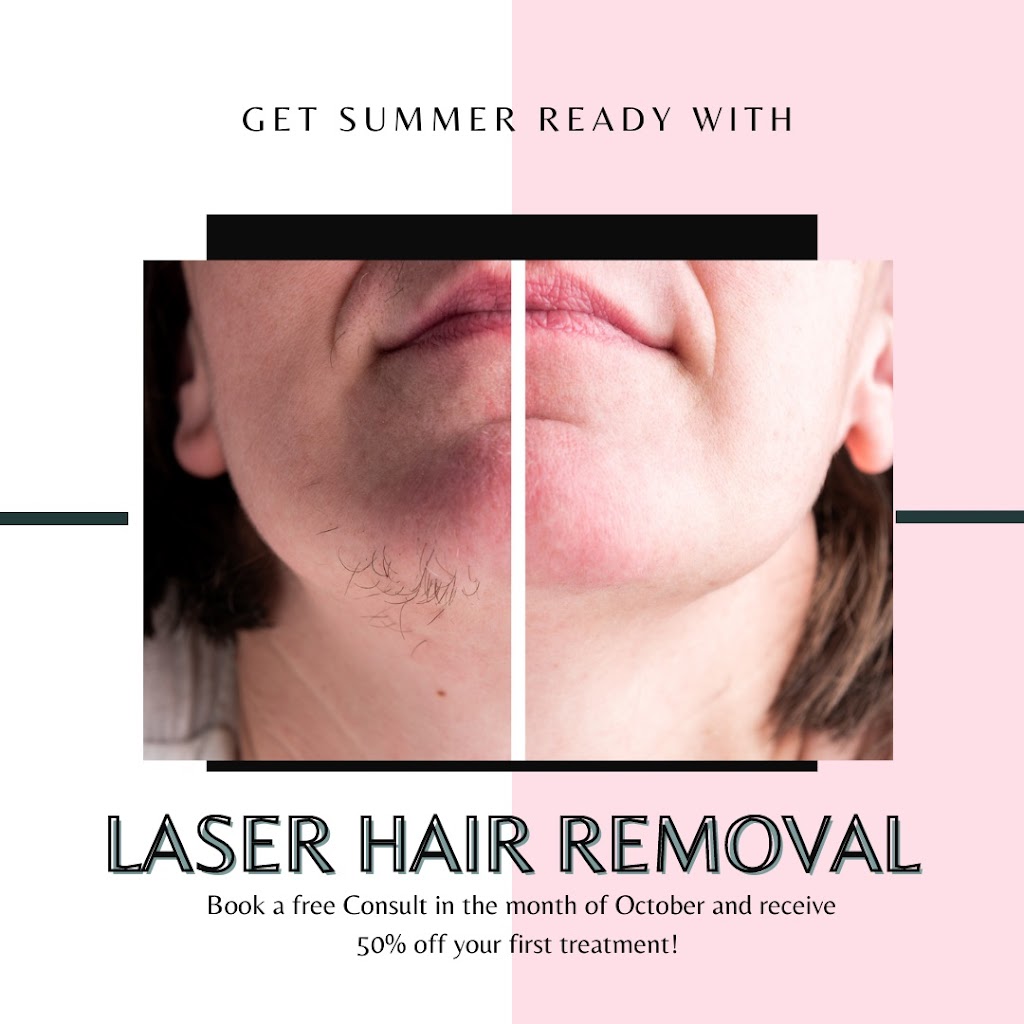 Voko Beauti Laser Hair Removal & Skin Care Clinic Chilliwack | 6396 Sumas Prairie Rd #3, Chilliwack, BC V2R 4N6, Canada | Phone: (778) 539-5577