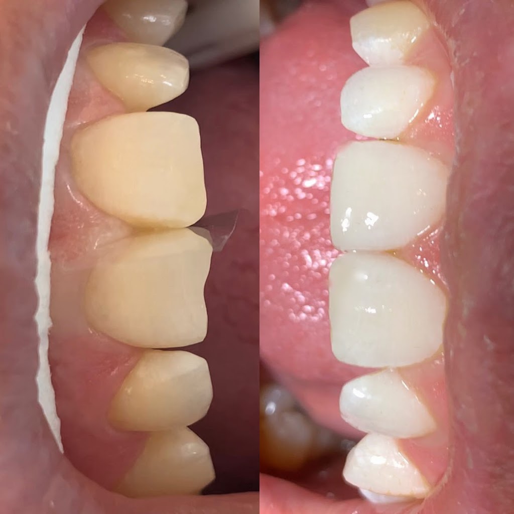 Dentistry At Bayview Glen | 8750 Bayview Ave Unit 3, Richmond Hill, ON L4B 4V9, Canada | Phone: (905) 882-0082