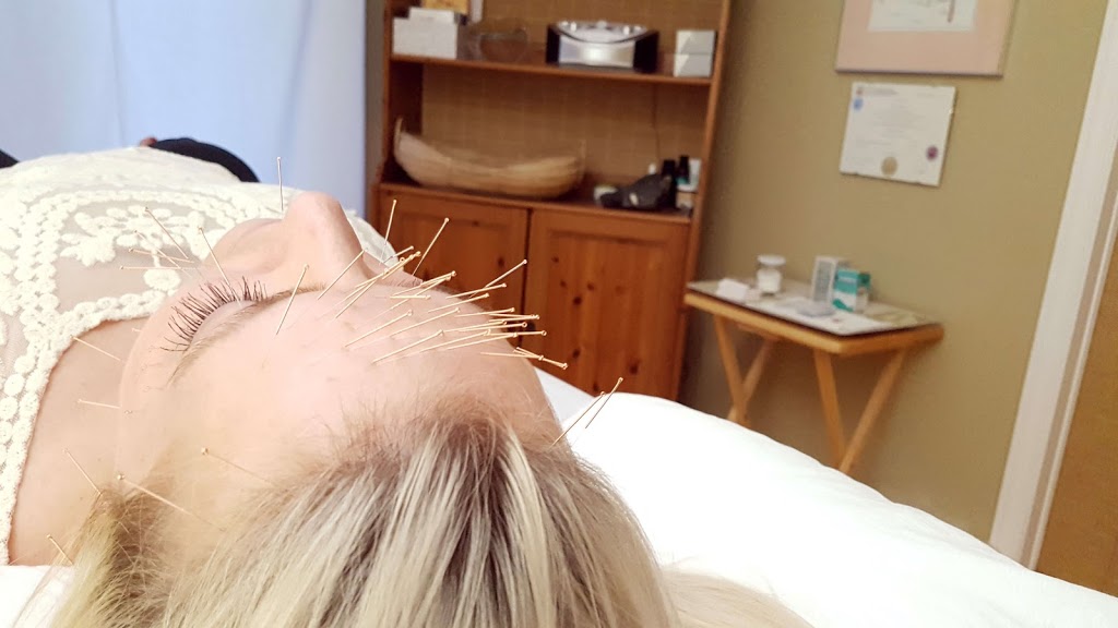 Harmony Acupuncture | 156 Kerry Hill Crescent, Dunrobin, ON K0A 1T0, Canada | Phone: (613) 832-0658
