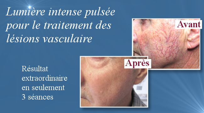 Coup DÉclat esthétique | 8280 1re Av., Québec, QC G1G 4C2, Canada | Phone: (418) 622-0911