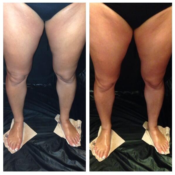 Sunkist Beauty | 67 Burns Cir, Barrie, ON L4N 5J8, Canada | Phone: (905) 960-2062