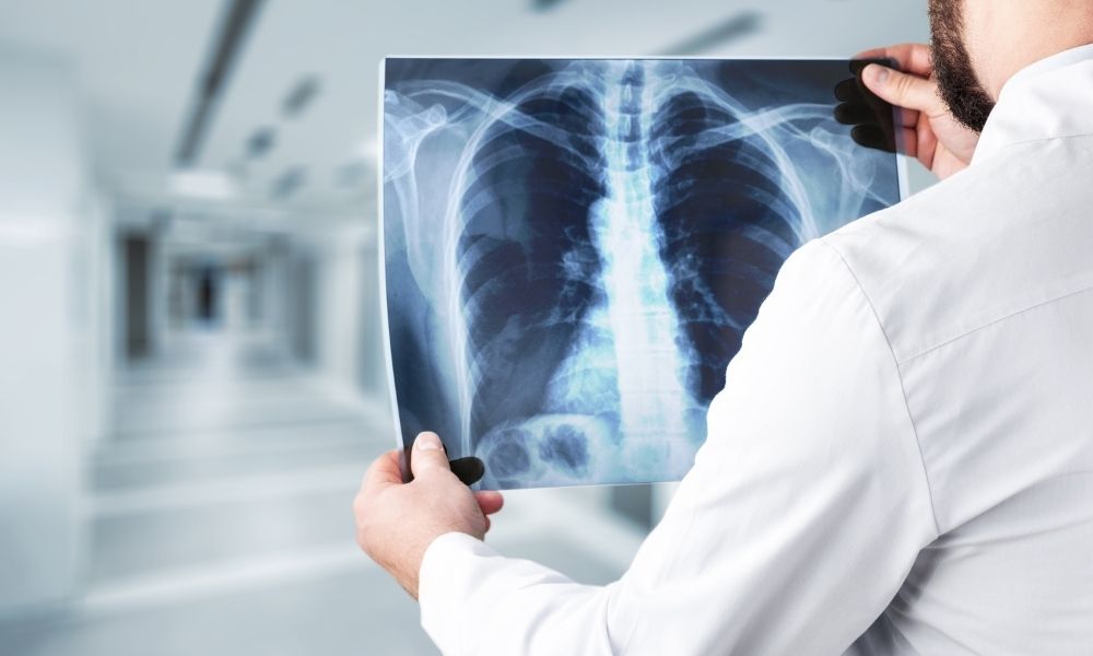 Tottenham Diagnostic Imaging | 120 Mill St E Unit 3, Tottenham, ON L0G 1W0, Canada | Phone: (905) 936-4005