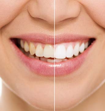 Savannah Dental Clinic | 1715 102 St NW, Edmonton, AB T6N 0B1, Canada | Phone: (780) 784-8284
