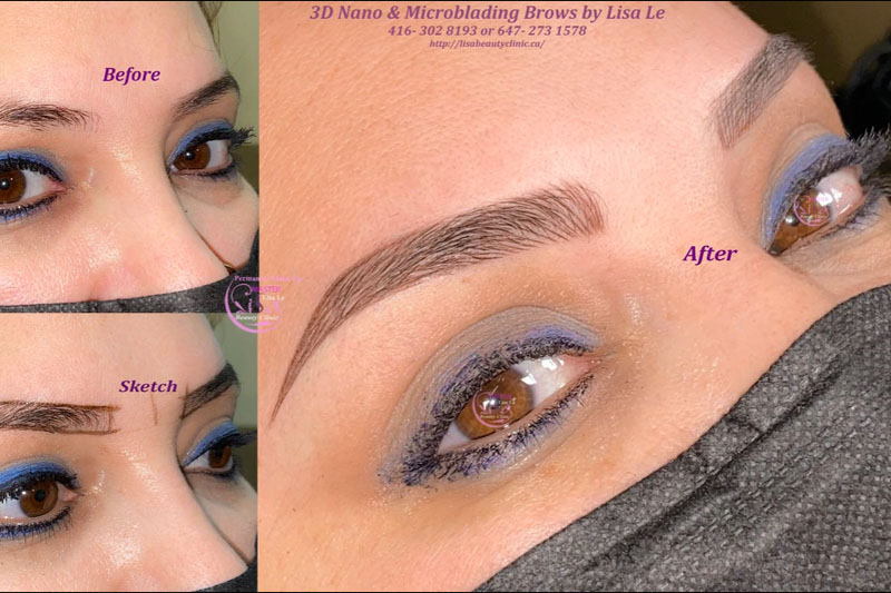 Lisa Beauty Clinic | 3220 Weston Rd, North York, ON M9M 2T7, Canada | Phone: (647) 273-1578