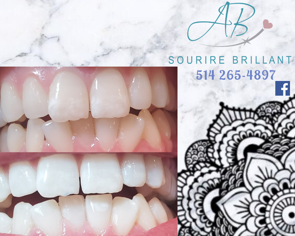 A.B. Sourire Brillant | 4600 Boulevard Sainte-Rose, Laval, QC H7R 1Z2, Canada | Phone: (514) 265-4897