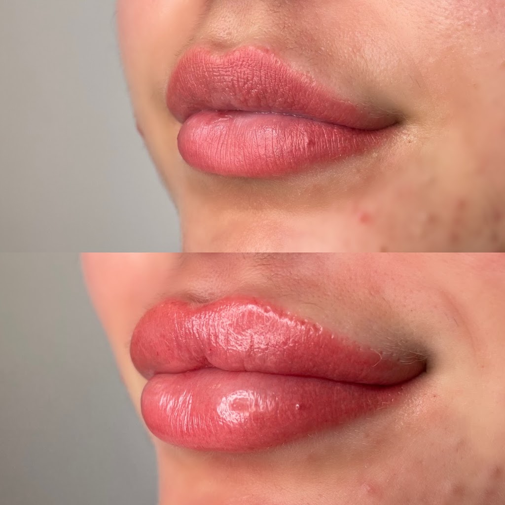 Natali Lischinski Medical Aesthetics & Cosmetic Tattoo | 8 Cooks Mill Crescent, Maple, ON L6A 0K8, Canada | Phone: (416) 700-3855