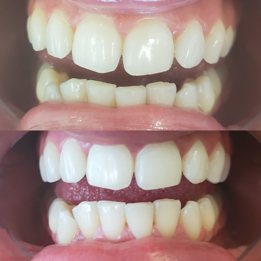 Whitening At Tiffanys | 46 Hannon Cres, Hannon, ON L0R 1P0, Canada | Phone: (905) 920-1398