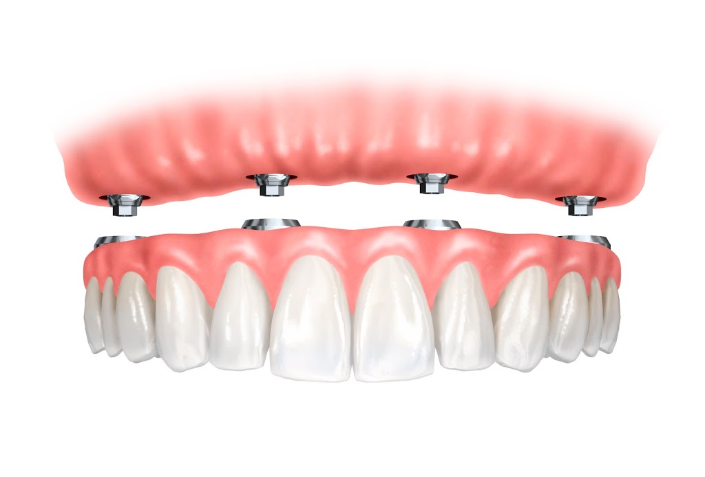 Dr. Ricky Leung | Dental Office | 2900 Steeles Ave E #201, Thornhill, ON L3T 4X1, Canada | Phone: (905) 881-3434