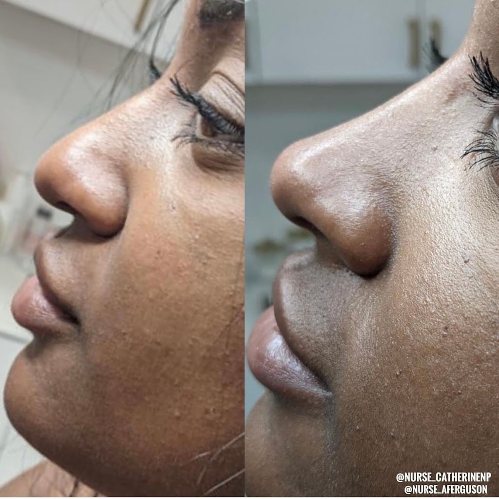 Monarchy Medispa Halifax | 480 Parkland Dr, Halifax, NS B3S 1P9, Canada | Phone: (902) 457-0525