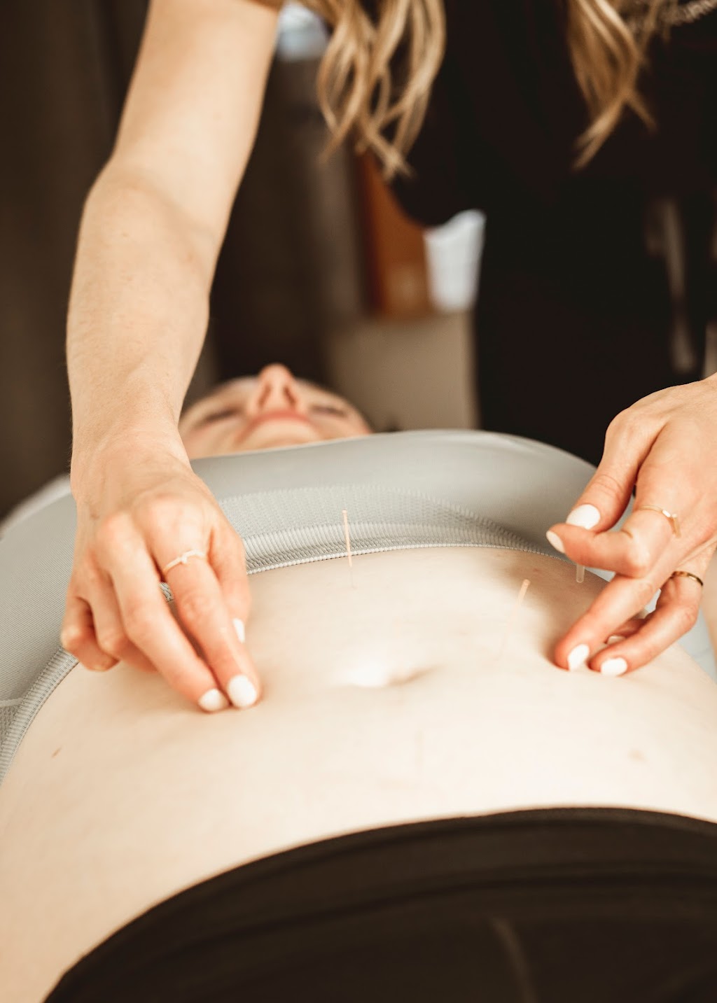 Acupuncture with Madison | 213 19 St NW #4, Calgary, AB T2N 2H9, Canada | Phone: (403) 283-0725