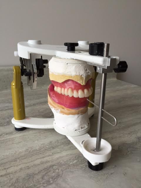 Ottawa South Denture Clinic | 2210 Prince of Wales Dr #701, Nepean, ON K2E 6Z9, Canada | Phone: (613) 695-9229