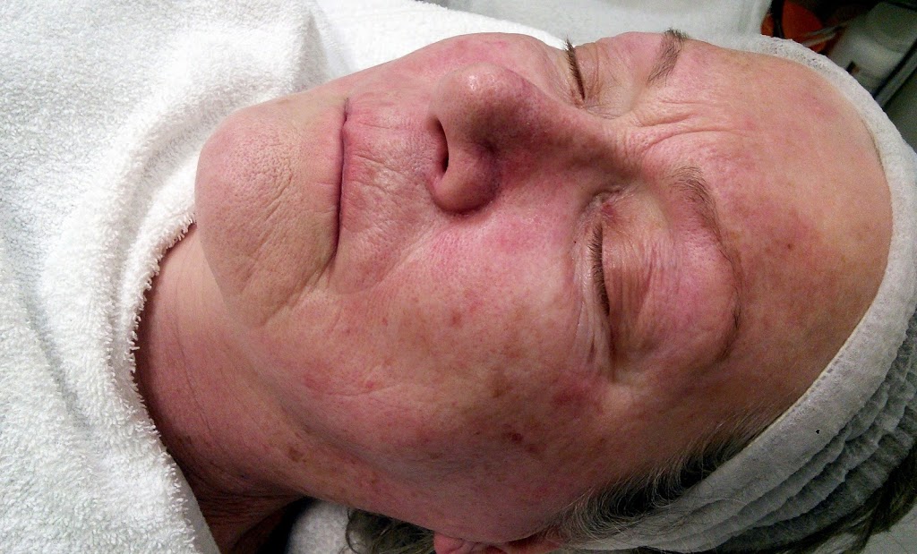 Unique Skin Care | 47 OShaughnessy Crescent, Barrie, ON L4N 7L8, Canada | Phone: (647) 978-1194