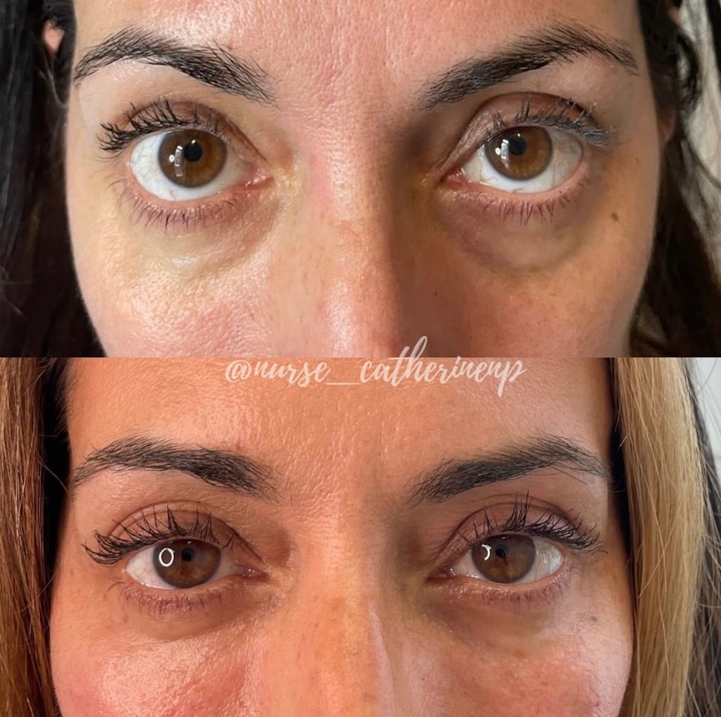 Monarchy Medispa Halifax | 480 Parkland Dr, Halifax, NS B3S 1P9, Canada | Phone: (902) 457-0525
