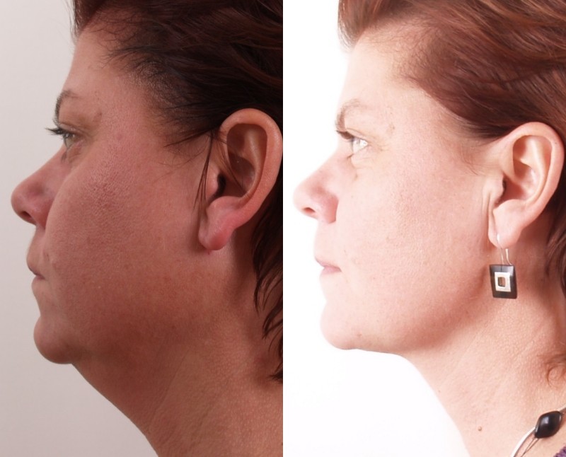 Concept Beauté MC | 2000 Rue des Patriotes bureau 5, Laval, QC H7L 2N8, Canada | Phone: (514) 546-0960