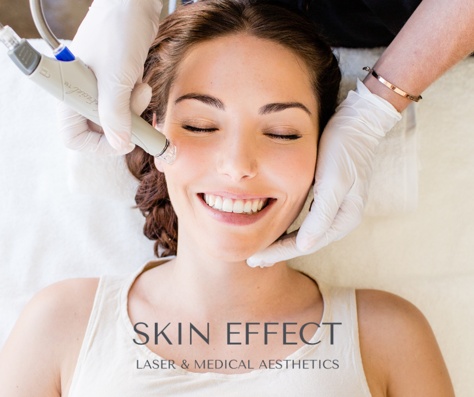 Skin Effect Laser and Medical Aesthetics | 10441 99 Ave Unit 701, Fort Saskatchewan, AB T8L 0V6, Canada | Phone: (780) 935-7546