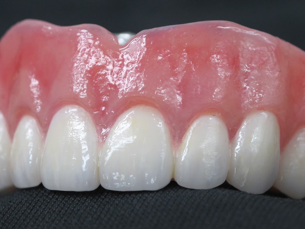 Inter Pro Dental Lab | 10578 109 St NW, Edmonton, AB T5H 3B2, Canada | Phone: (780) 429-2567