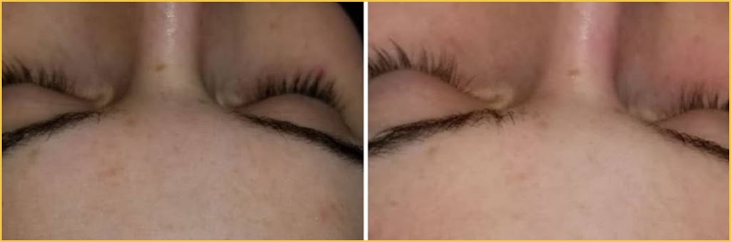 Awaken HydraFacial Windsor | 3926 Concession Rd 6, Windsor, ON N9G 2H4, Canada | Phone: (226) 777-6645