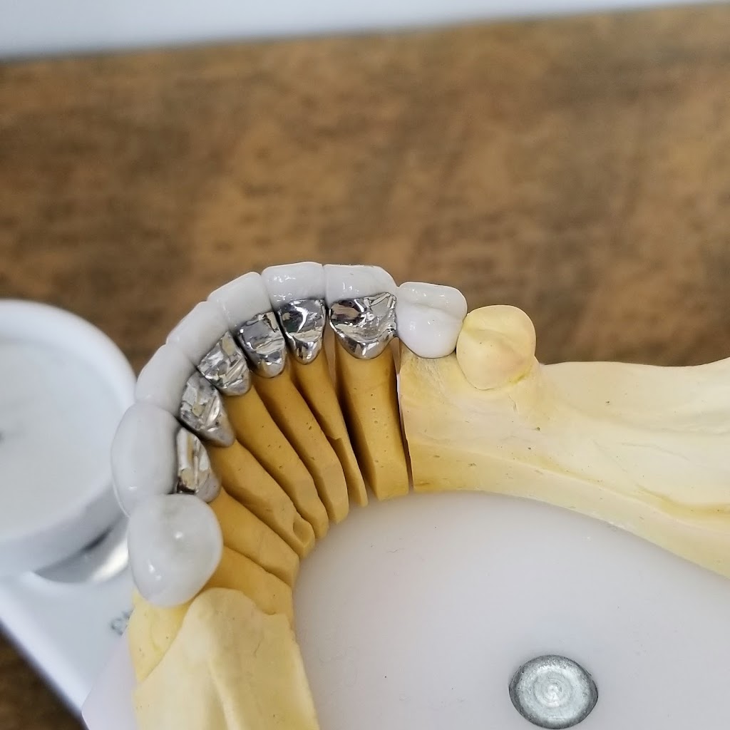 Laboratoire Dentaire Nor-Lab Inc | 97 Rue Marcotte, Saint-Jérôme, QC J7Y 5C9, Canada | Phone: (450) 431-5958