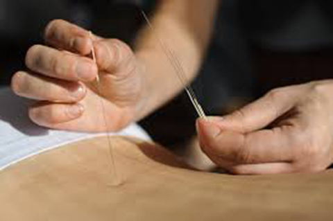 Geneviève Goudreault Acupuncteure | 180 QC-170, LAnse-Saint-Jean, QC G0V 1J0, Canada | Phone: (418) 272-2722