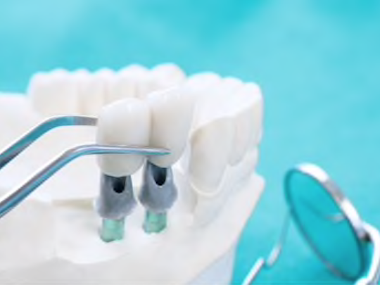 Dr. Eric Rodrigue Dental Clinic - Clinique Dentaire | 261 Montreal Rd #410, Vanier, ON K1L 8C7, Canada | Phone: (613) 749-9541