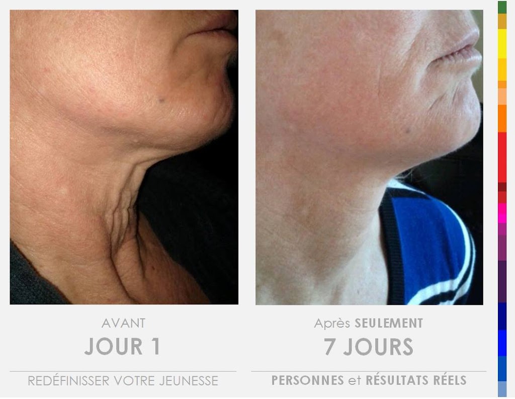 evolution beaute | 1172 Rue Saint Louis, Saint-Jean-Chrysostome, QC G6Z 2L2, Canada | Phone: (418) 956-9488