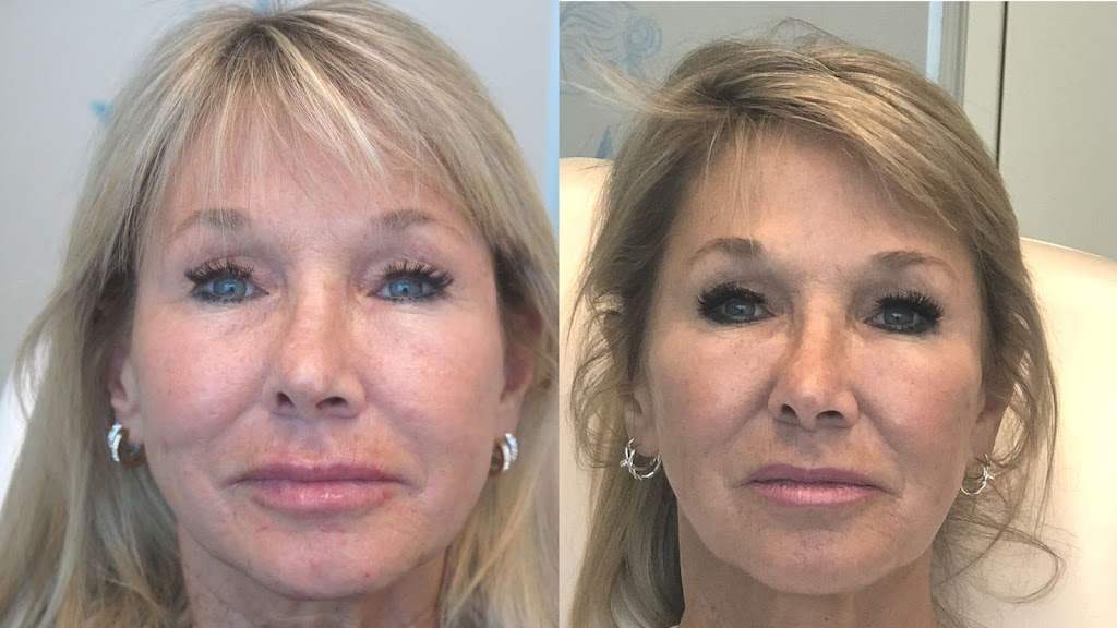 White Rock Skin and Laser Clinic | 15850 26 Ave #101, Surrey, BC V3Z 2N6, Canada | Phone: (778) 545-1925
