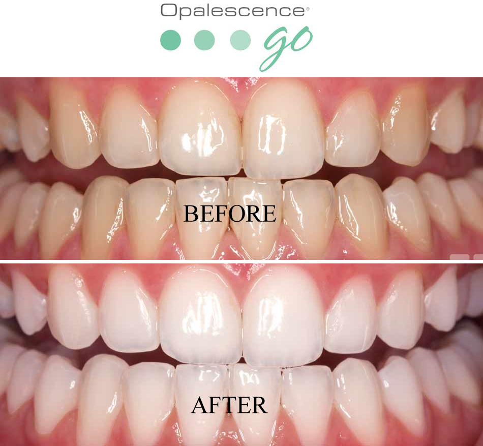 Dr Nancy Bishay & Associates Family Dental office | 4190 Finch Ave E #206, Scarborough, ON M1S 4T7, Canada | Phone: (416) 297-0071