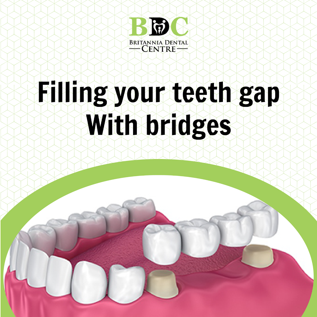Britannia Dental Centre | 40 Finchgate Blvd Suite #310, Brampton, ON L6T 3H9, Canada | Phone: (905) 792-2030