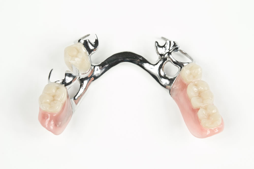 Smile Denture & Implant Clinic | 1825 Woodward Dr, Ottawa, ON K2C 0P9, Canada | Phone: (613) 702-2656