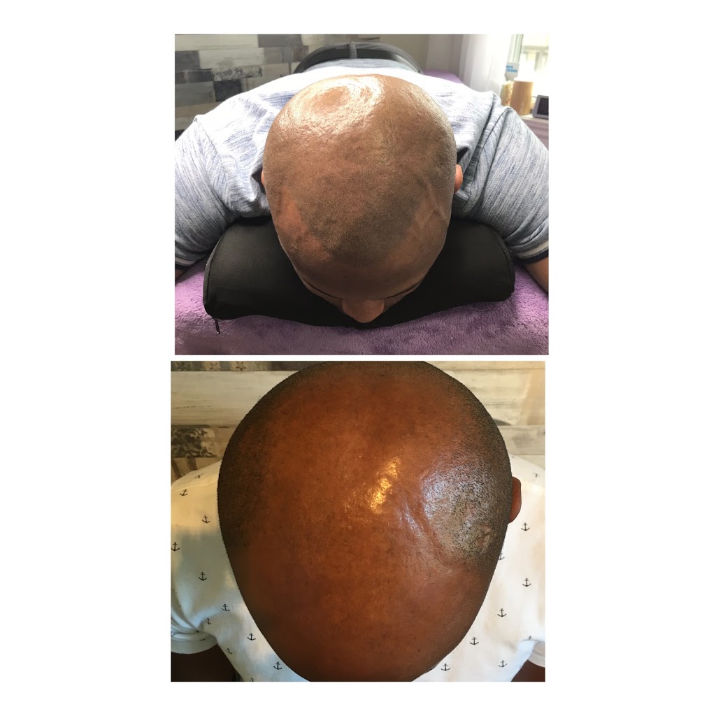 Micropigmentation Capillaire & Maquillage Permanent Marie-Josée  | 4096 Rue des Thuyas bureau 1, Québec, QC G1G 0G6, Canada | Phone: (418) 573-7154