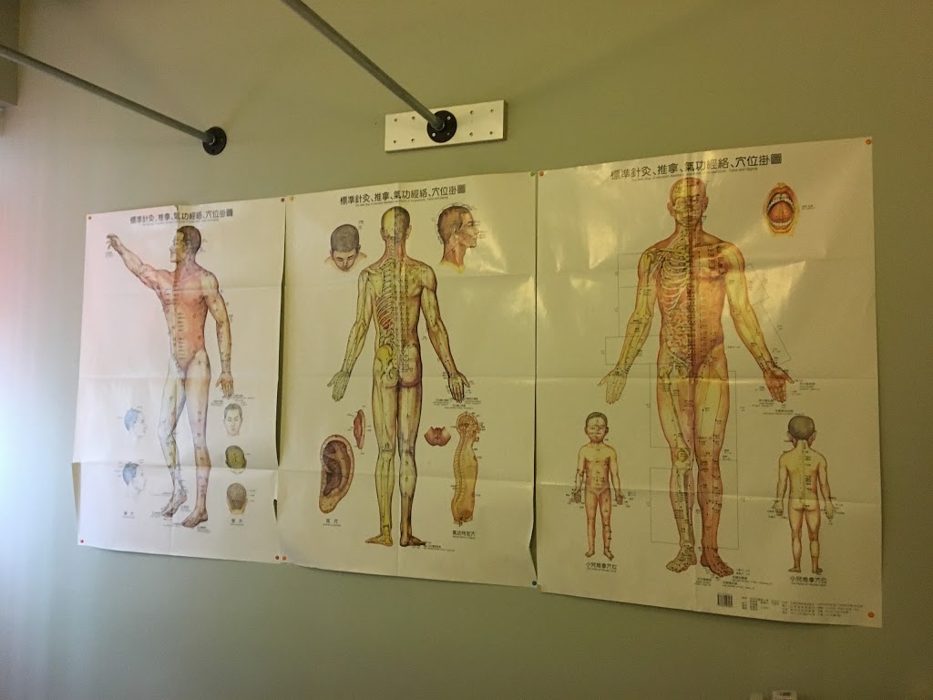 Kuns Acupuncture Clinic | 808 Britannia Rd W, Mississauga, ON L5V 0A7, Canada | Phone: (647) 955-3108