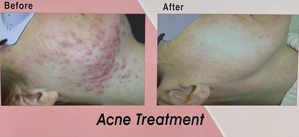Laura Beauty & Laser Home Med Spa | 144 Solomon Crescent, Hamilton, ON L8W 2G7, Canada | Phone: (289) 775-8875