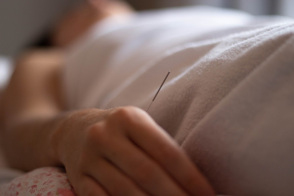 Emilie Lagarde Acupuncture | 253 Chemin de Lavaltrie bureau 102, Lavaltrie, QC J5T 2G8, Canada | Phone: (514) 627-0032