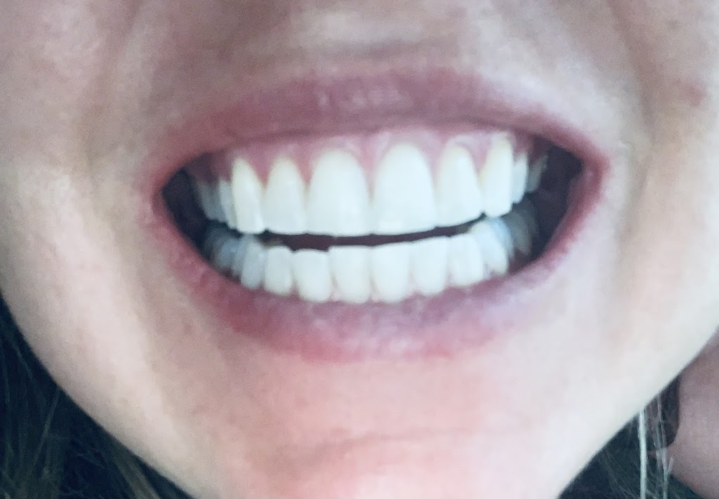 Creekview Dental Hygiene | Box 2967, 975 Canon St, Pincher Creek, AB T0K 1W0, Canada | Phone: (403) 627-8303