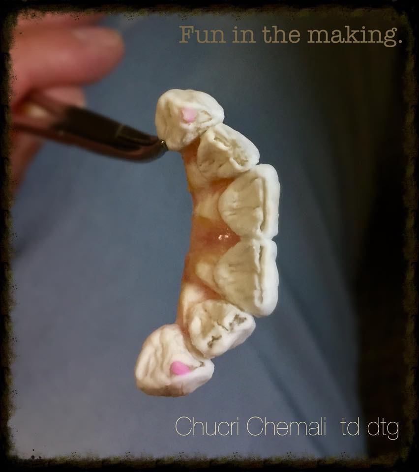 Chemali Laboratoire Dentaire | 3221 Autoroute 440 Ouest Bur 232, Laval, QC H7P 5P2, Canada | Phone: (450) 505-6066