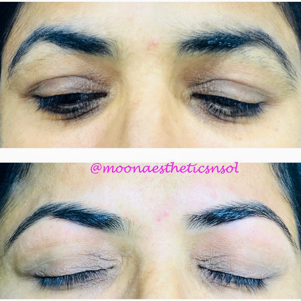 Moon Aesthetics n Solutions | 159 Shephard Ave, Alliston, ON L9R 0J8, Canada | Phone: (705) 718-1836