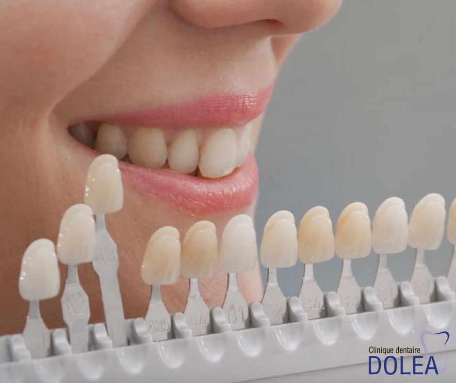 Clinique dentaire Dolea | 116 Boulevard Cardinal Léger, Pincourt, QC J7W 3Y5, Canada | Phone: (514) 453-9810