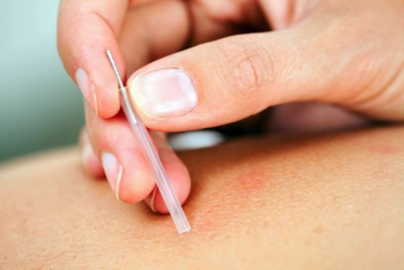 Acupuncture Chantal Deschênes, Ac. | 210 Rue des Boisés de Rigaud, Rigaud, QC J0P 1P0, Canada | Phone: (514) 677-0897